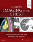 Muller's Imaging of the Chest : Expert Radiology Series - Book