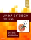 Lumbar Interbody Fusions - Book