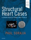 Structural Heart Cases : A Color Atlas of Pearls and Pitfalls - Book