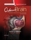 Osborn's Brain E-Book - eBook