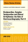 Clinical Arrhythmias: Bradicardias, Complex Tachycardias and Particular Situations: Part II, An Issue of Cardiac Electrophysiology Clinics : Volume 10-2 - Book