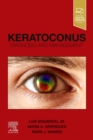 Keratoconus : Diagnosis and Management - Book