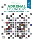 Adrenal Disorders : 100 Cases from the Adrenal Clinic - Book
