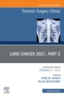 Lung Cancer 2021, Part 2, An Issue of Thoracic Surgery Clinics, E-Book - eBook