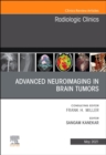 Advanced Neuroimaging in Brain Tumors, An Issue of Radiologic Clinics of North America : Volume 59-3 - Book