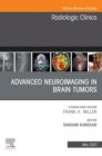 Advanced Neuroimaging in Brain Tumors, An Issue of Radiologic Clinics of North America, E-Book : Advanced Neuroimaging in Brain Tumors, An Issue of Radiologic Clinics of North America, E-Book - eBook