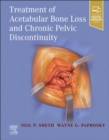 Treatment of Acetabular Bone Loss and Chronic Pelvic Discontinuity - Book