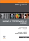 Imaging of Cerebrovascular Disease, An Issue of Radiologic Clinics of North America : Volume 61-3 - Book
