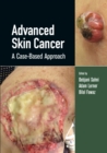 Advanced Skin Cancer : A Case-Based Approach - Book