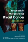 Handbook of Metastatic Breast Cancer - Book