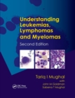 Understanding Leukemias, Lymphomas and Myelomas - Book