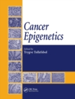 Cancer Epigenetics - Book