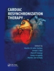 Cardiac Resynchronization Therapy - Book