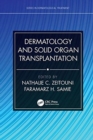 Dermatology and Solid Organ Transplantation - Book