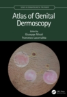 Atlas of Genital Dermoscopy - Book