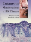 Cutaneous Manifestations of HIV Disease - Book