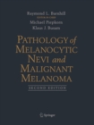 Pathology of Melanocytic Nevi and Malignant Melanoma - eBook