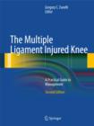 The Multiple Ligament Injured Knee : A Practical Guide to Management - Book