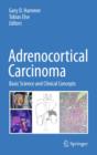 Adrenocortical Carcinoma : Basic Science and Clinical Concepts - Book