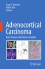 Adrenocortical Carcinoma : Basic Science and Clinical Concepts - eBook