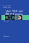 Hybrid PET/CT and SPECT/CT Imaging : A Teaching File - eBook