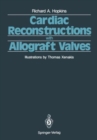Cardiac Reconstructions with Allograft Valves - Book