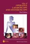 Atlas of Operative Laparoscopy and Hysteroscopy - Book
