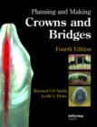 Planning and Making Crowns and Bridges - Book