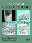 An Atlas of Osteoporosis - Book