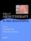 Atlas of Mesotherapy in Skin Rejuvenation - Book