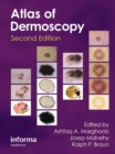 An Atlas of Dermoscopy - Book