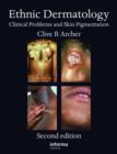 Ethnic Dermatology : Clinical Problems and Skin Pigmentation - Book
