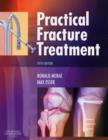 Practical Fracture Treatment - Book