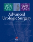 Advanced Urologic Surgery - eBook