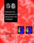 Magnetic Resonance Imaging in Stroke - eBook