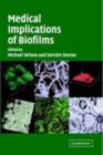 Medical Implications of Biofilms - eBook