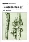 Palaeopathology - eBook