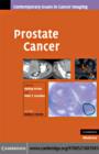 Prostate Cancer - eBook