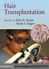 Hair Transplantation - eBook