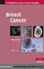 Breast Cancer - eBook