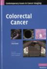 Colorectal Cancer - eBook
