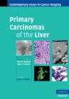 Primary Carcinomas of the Liver - eBook