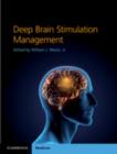 Deep Brain Stimulation Management - eBook