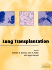 Lung Transplantation - Book