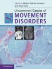 Uncommon Causes of Movement Disorders - Book