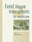 Fetal Tissue Transplants in Medicine - Book