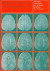 Magnetic Resonance in Multiple Sclerosis - Book