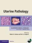 Uterine Pathology - Book