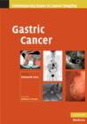 Gastric Cancer - Book