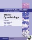 Breast Cytohistology with DVD-ROM - Book